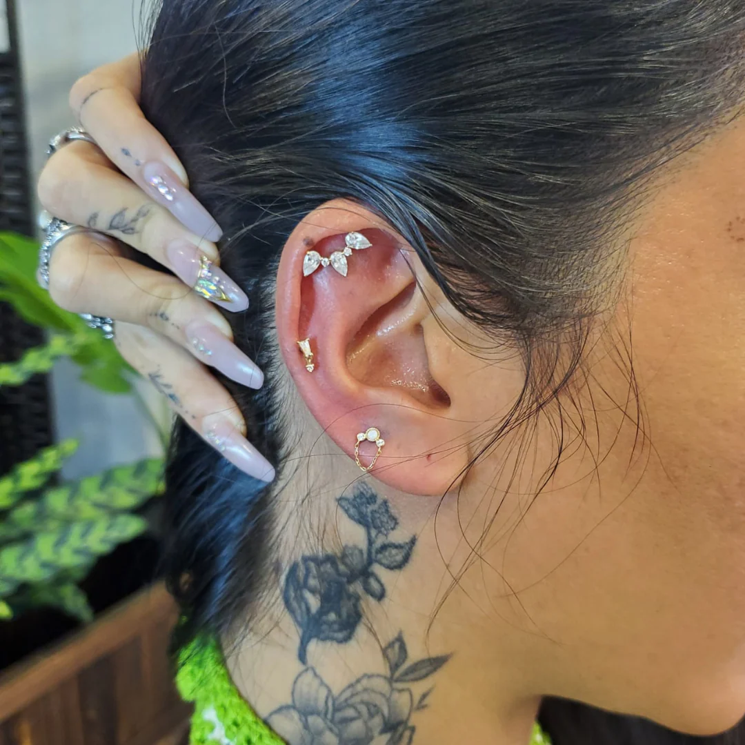 Piercing Removal - Image 2